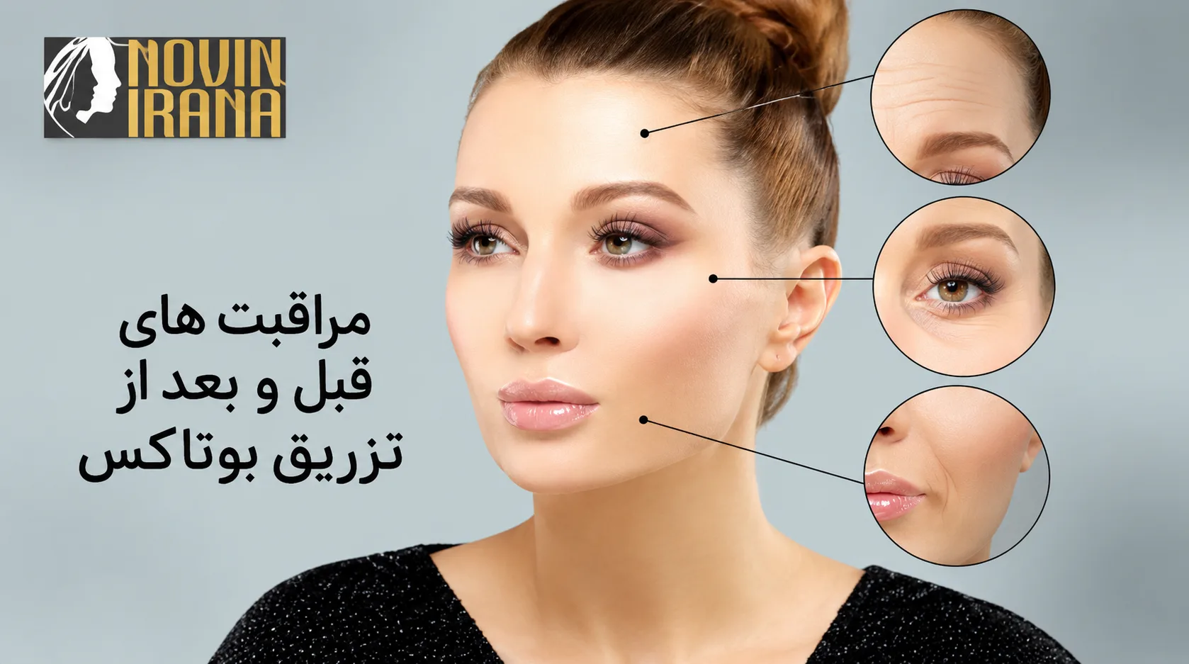 مراقبت های قبل و بعد بوتاکس